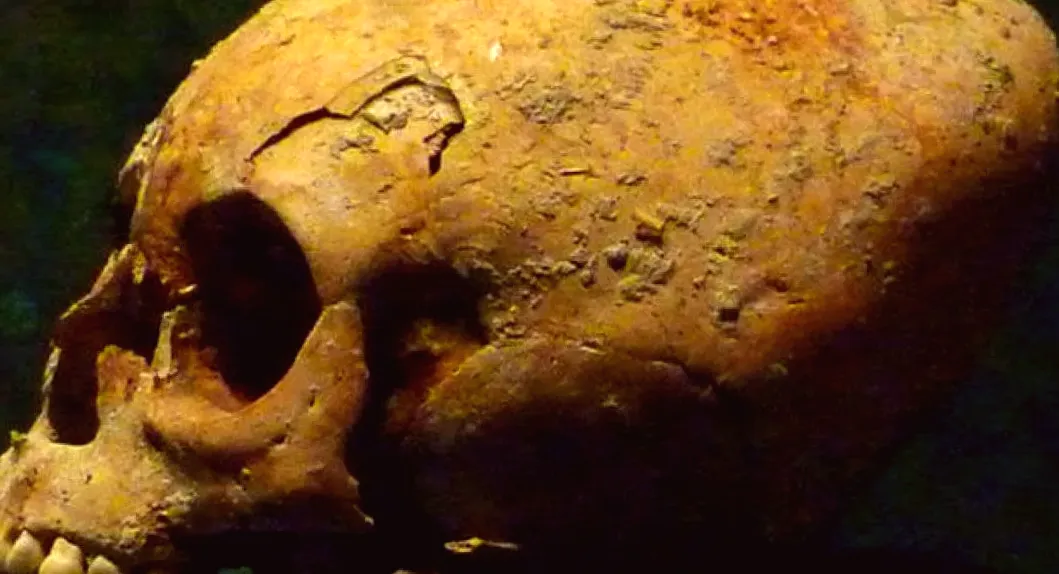 Discovery of Strange Skull Sheds Light on Mysterious Ancient Ritual