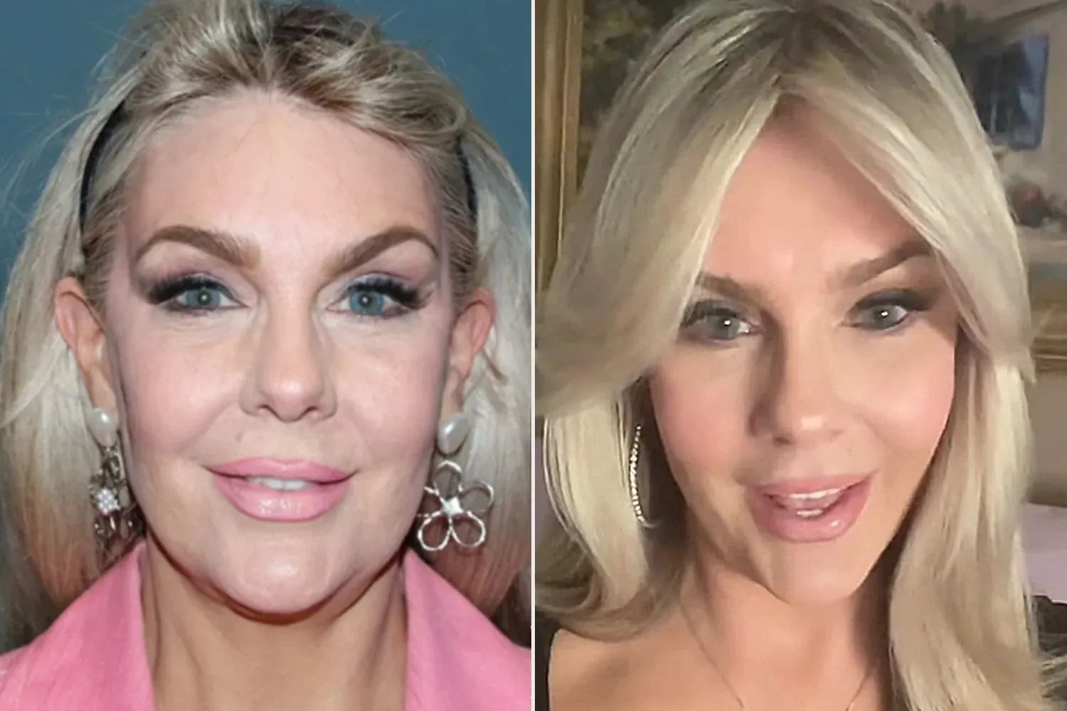 61-Year-Old Woman's Cosmetic Procedures Shed Light on Reasons Women Choose Plastic Surgery