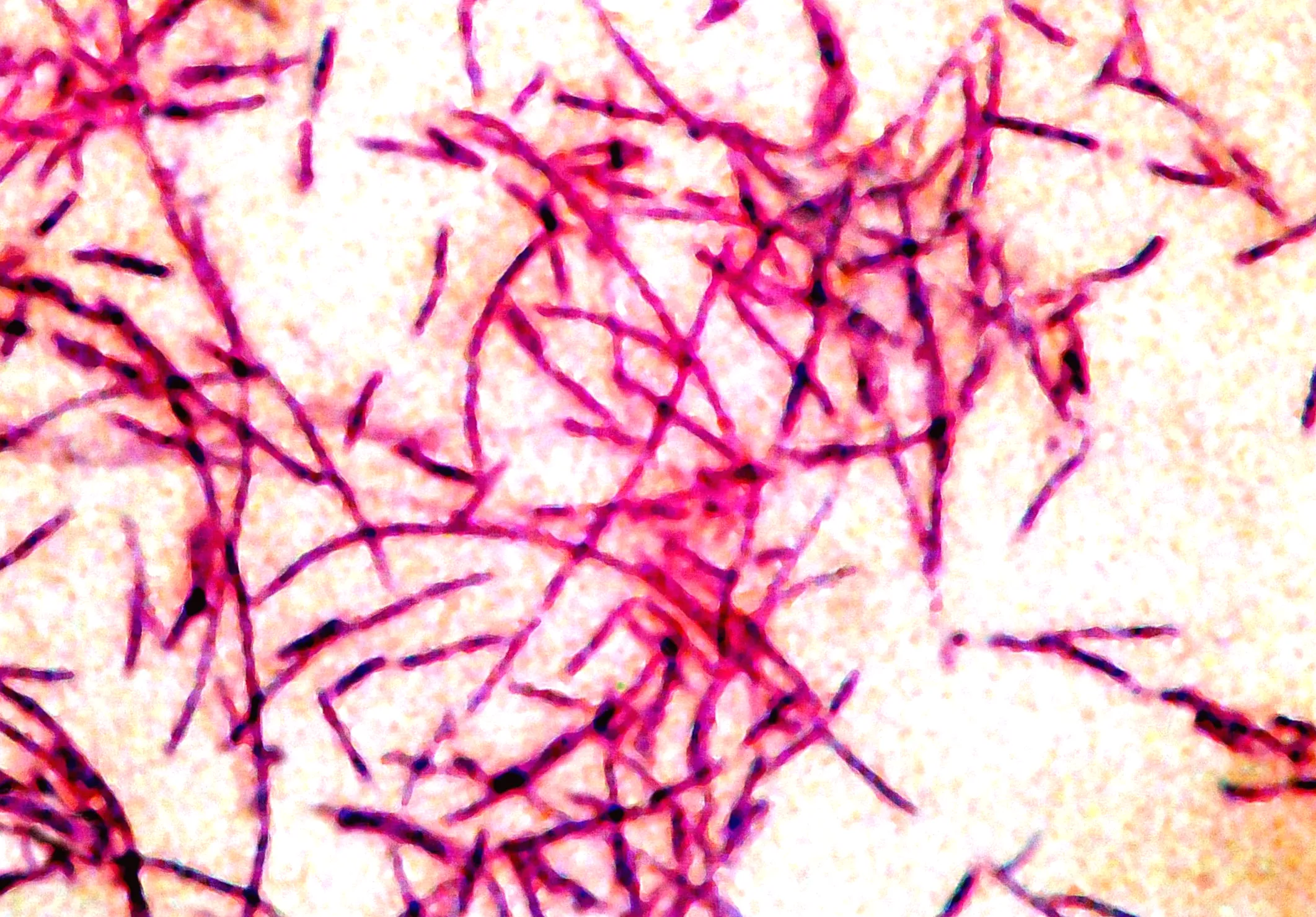 Outbreak of Legionnaires' disease in Florida possibly connected to gym with 14 reported cases