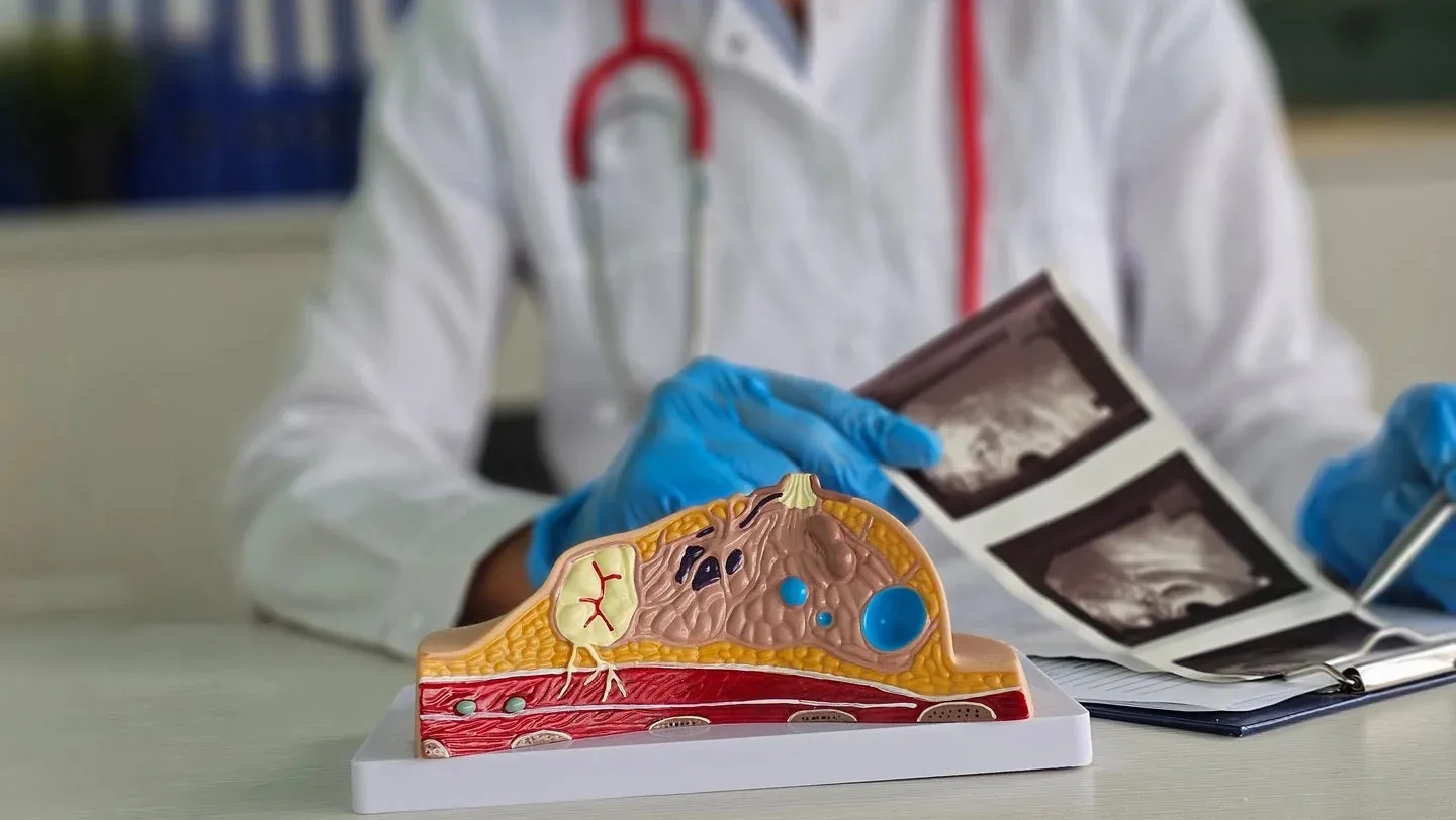 MHRA gives approval to Roche Products’ inavolisib for treating breast cancer